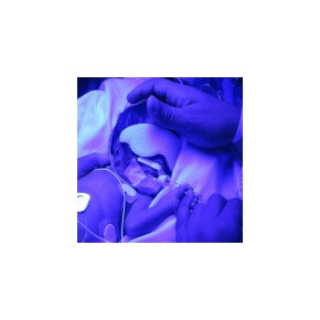 Antifaz para protección ocular, prematuro (paquete con 5 piezas) BEL-FOT-ANT-5P MARCA -  Bhelius